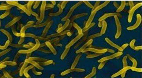 微生物菌劑好？好在哪里您知道嗎？